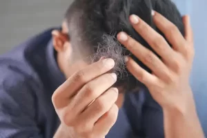 Man Showing Shedding Hair Close Up